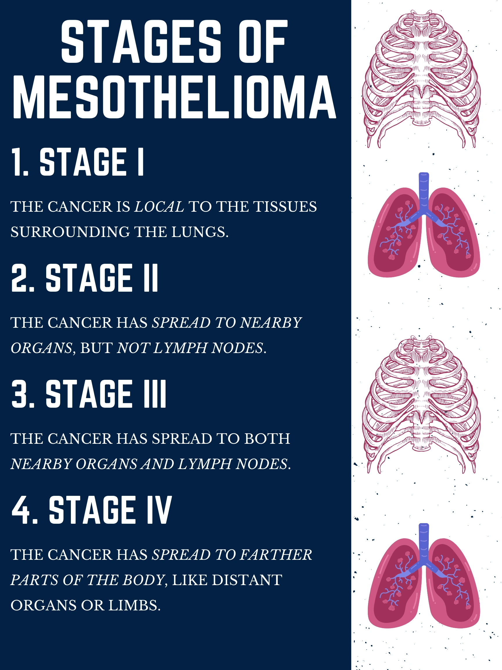 10 Glendale Mesothelioma Lawyer Resources On Vimeo