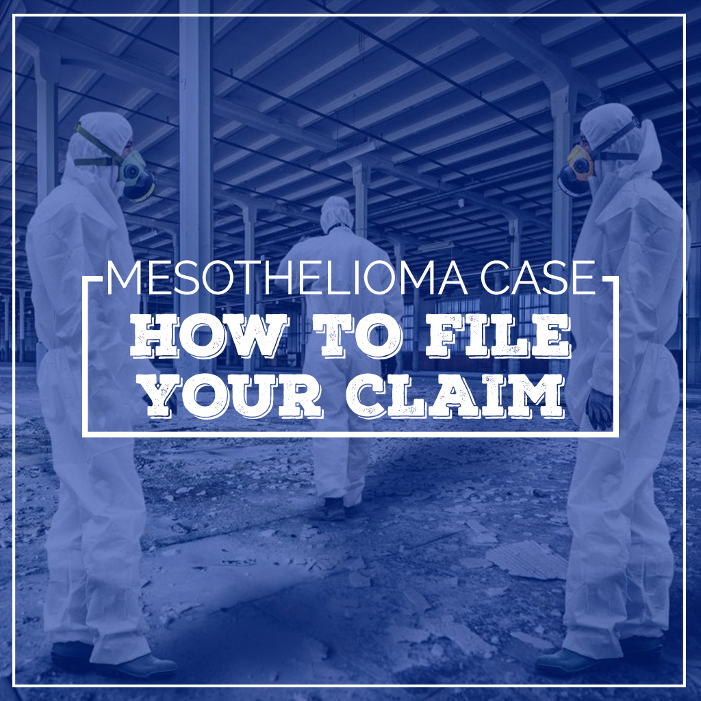 15+ Tips To Find The Right Lawyer For Your Mesothelioma Case