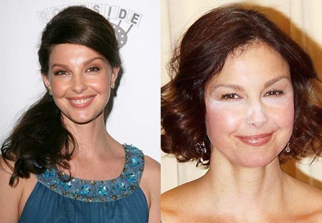 Ashley Judd Plastic Surgery Before And After Botox Pictures