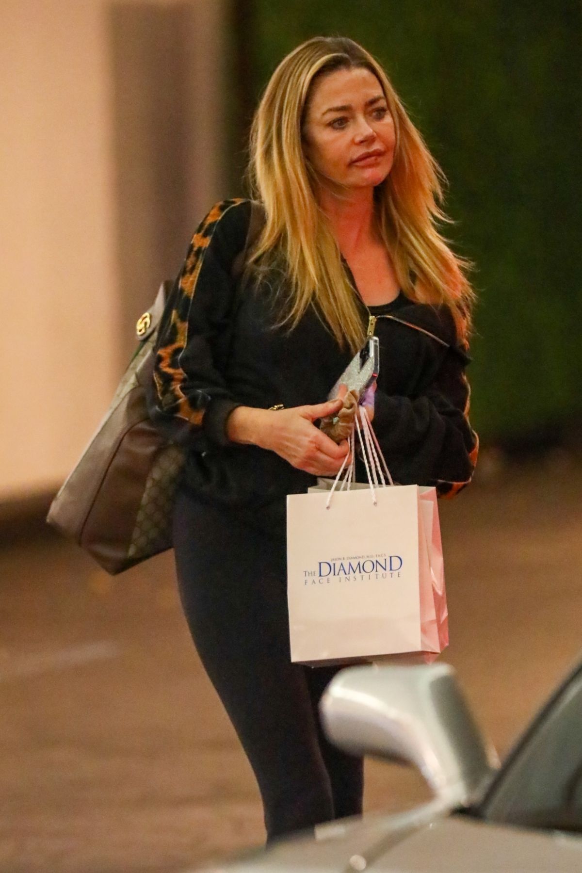 Denise Richards Leaving The Diamond Face Institute Surgical Center In