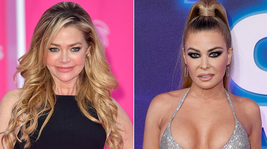 Denise Richards Reveals Procedure After Fans Slam Her For Surgery