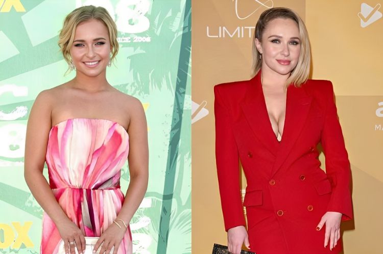 Did Hayden Panettiere Had Undergone Plastic Surgery Full