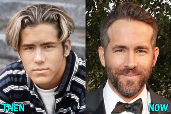 Ryan Reynolds Plastic Surgery Before And After