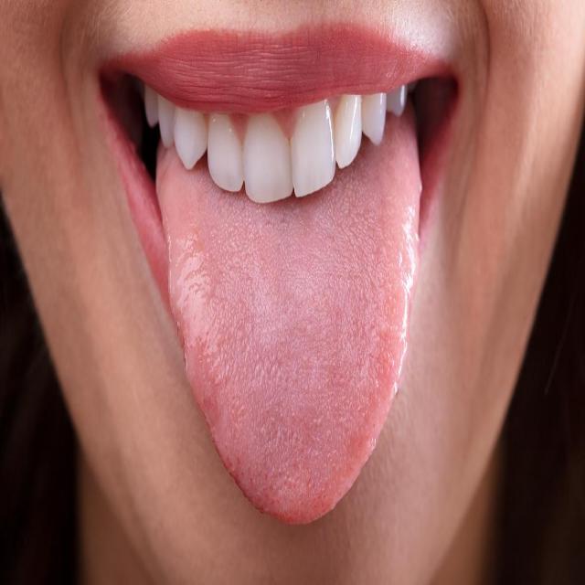 Samples Of Tongue Image Dataset Download Scientific Diagram