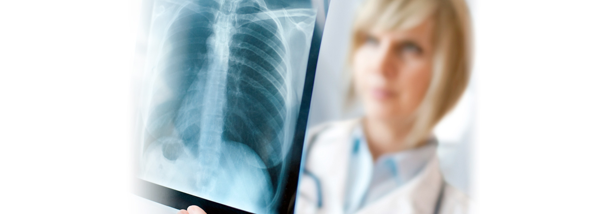 When To Contact A Mesothelioma Specialist? Your Legal Options